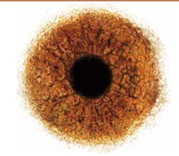 青光眼症狀急性青光眼青光眼英文