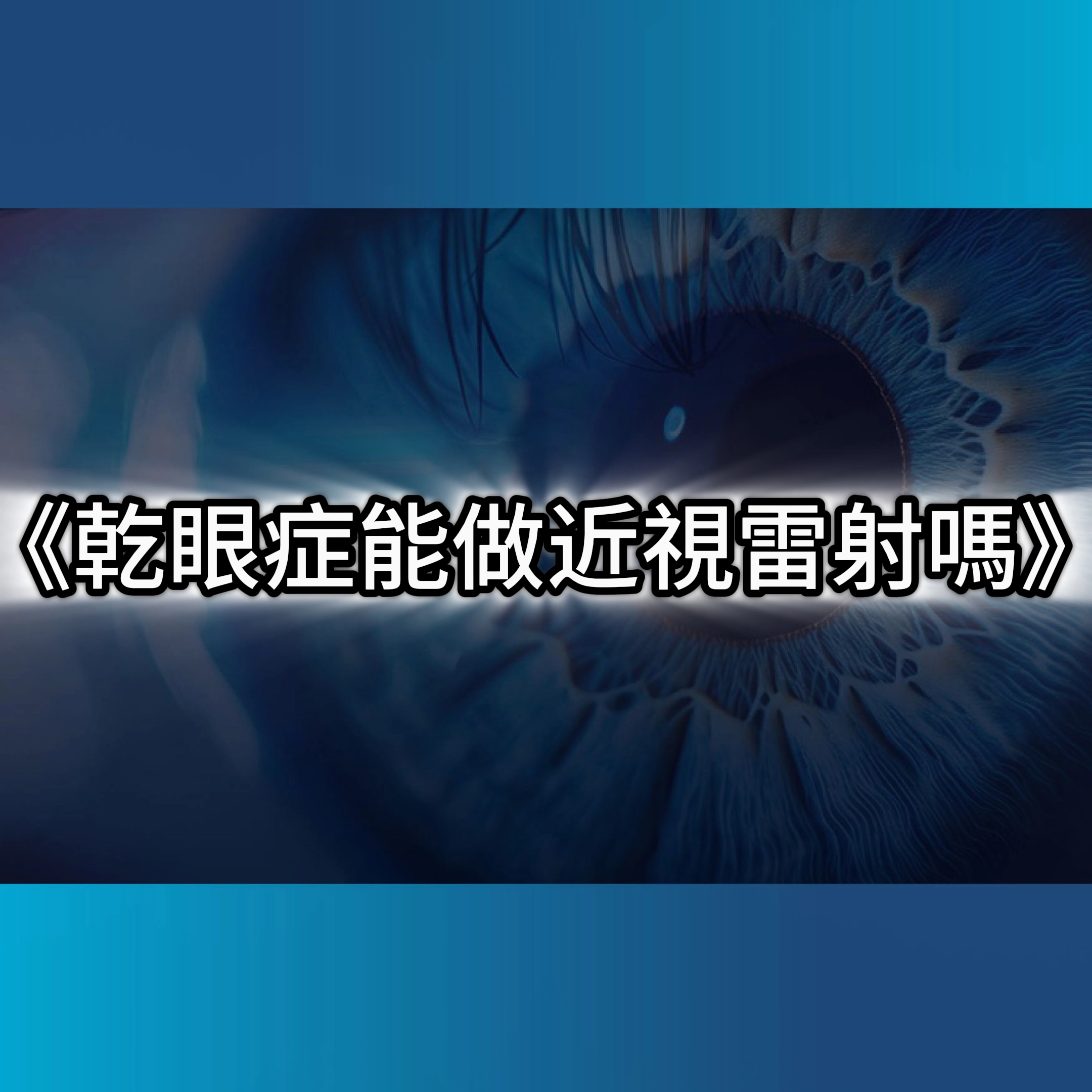 SMILE全飛秒,近視雷射,乾眼症治療