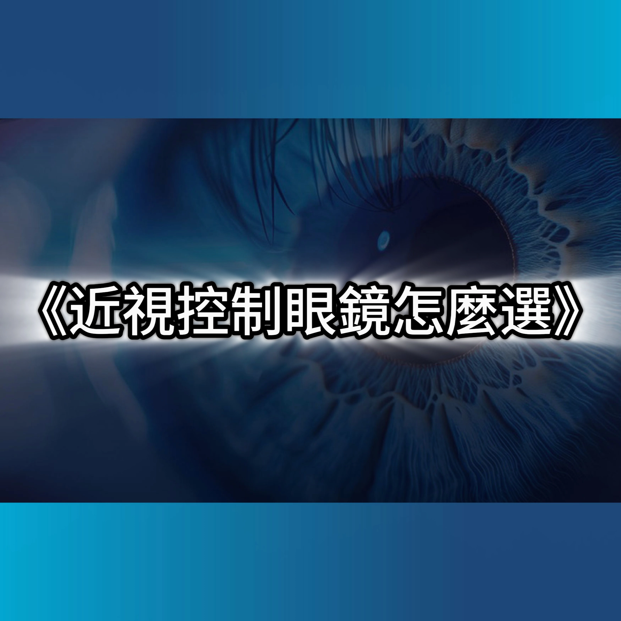 近視控制眼鏡,兒童近視,角膜塑型片