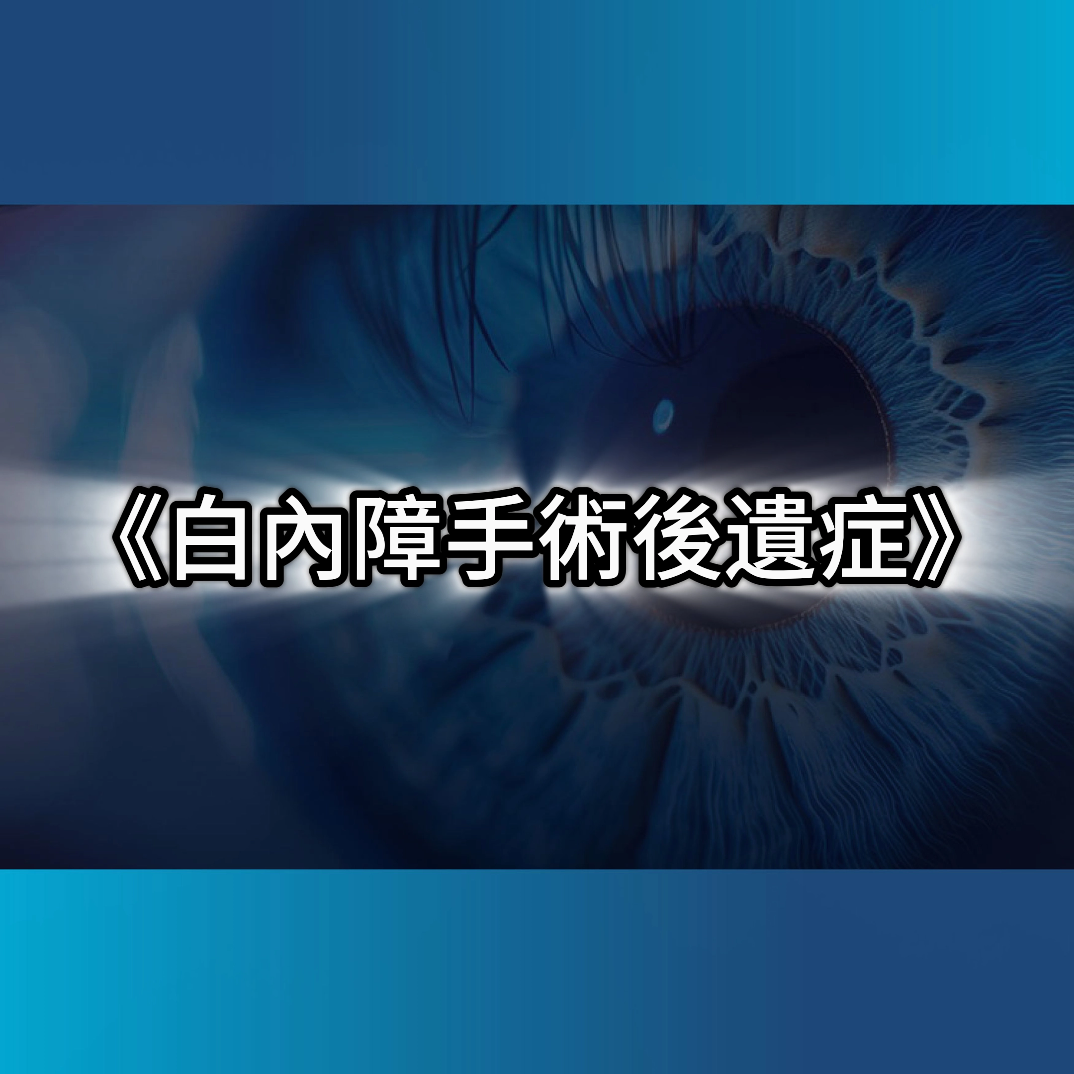 白內障手術,白內障症狀,白內障