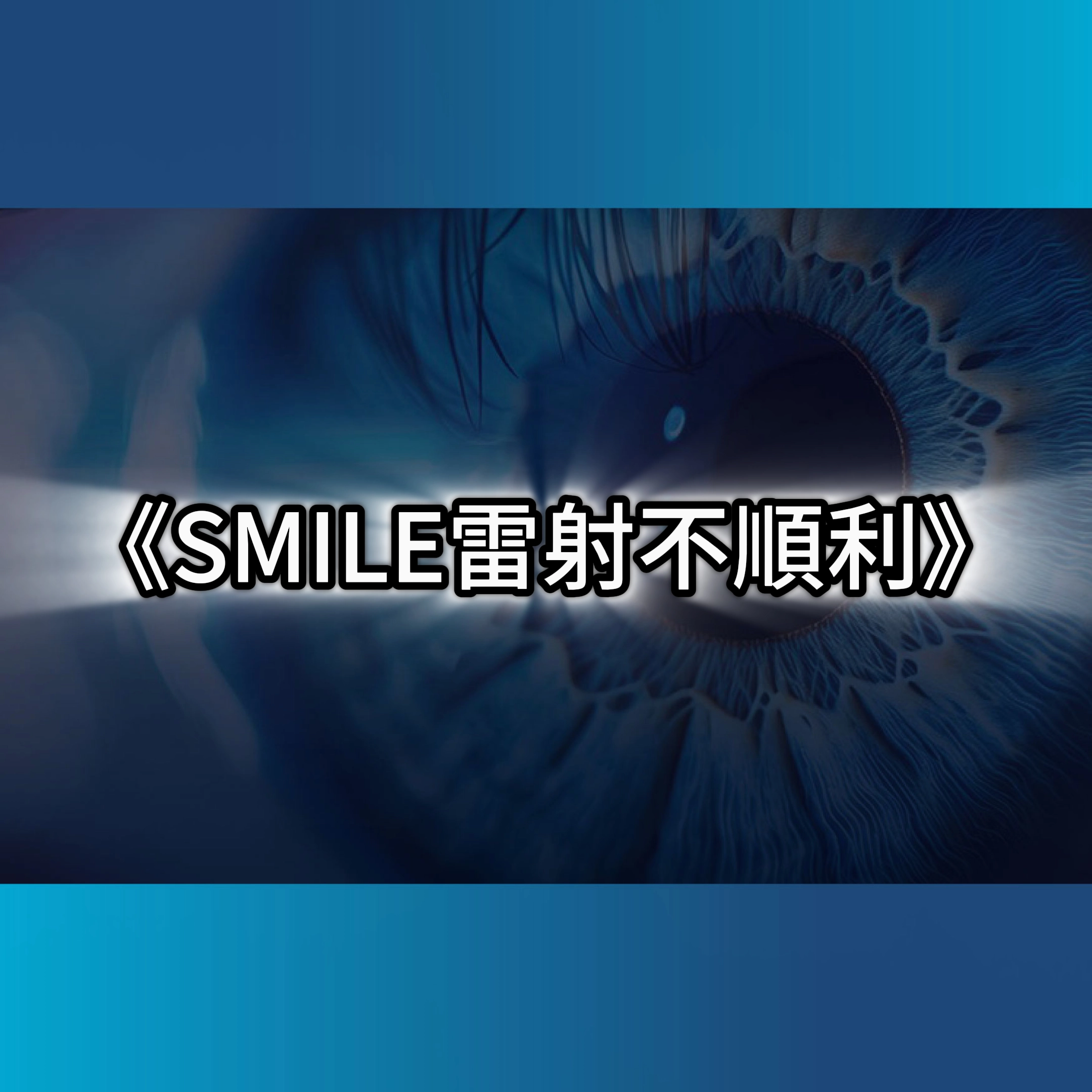 smile雷射,smile失敗,smile雷射手術