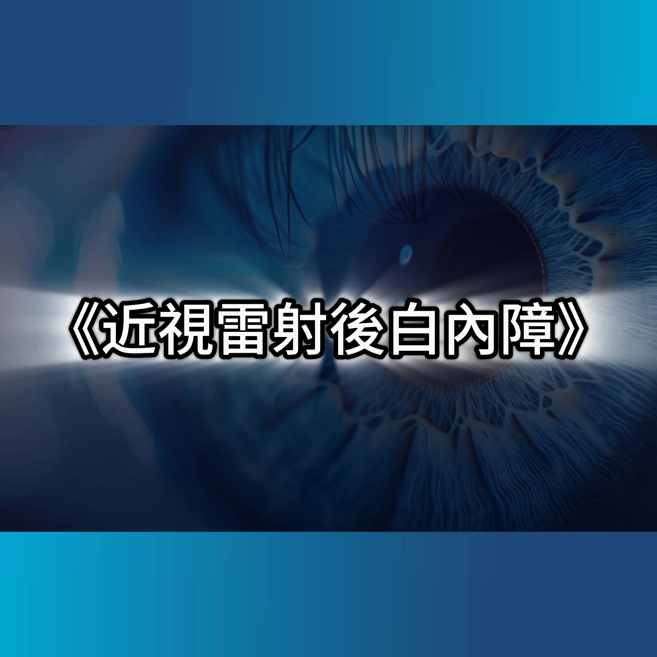 白內障人工水晶體,smile全飛秒,smilepro