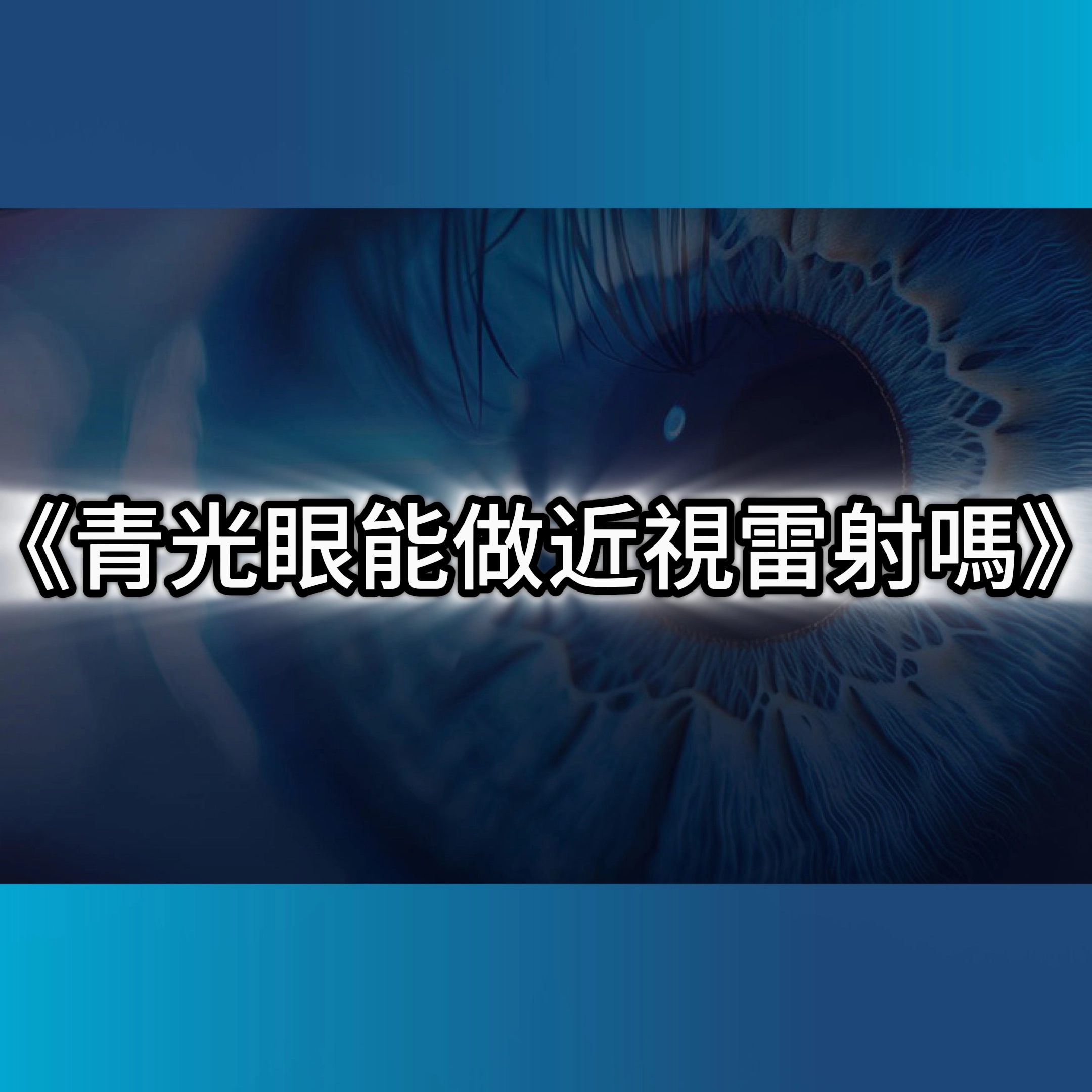 近視雷射SMILE,青光眼,青光眼治療