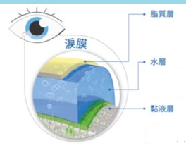 乾眼症乾眼症治療脈衝光乾眼症費用