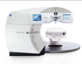 smile雷射價格smile雷射近視雷射手術