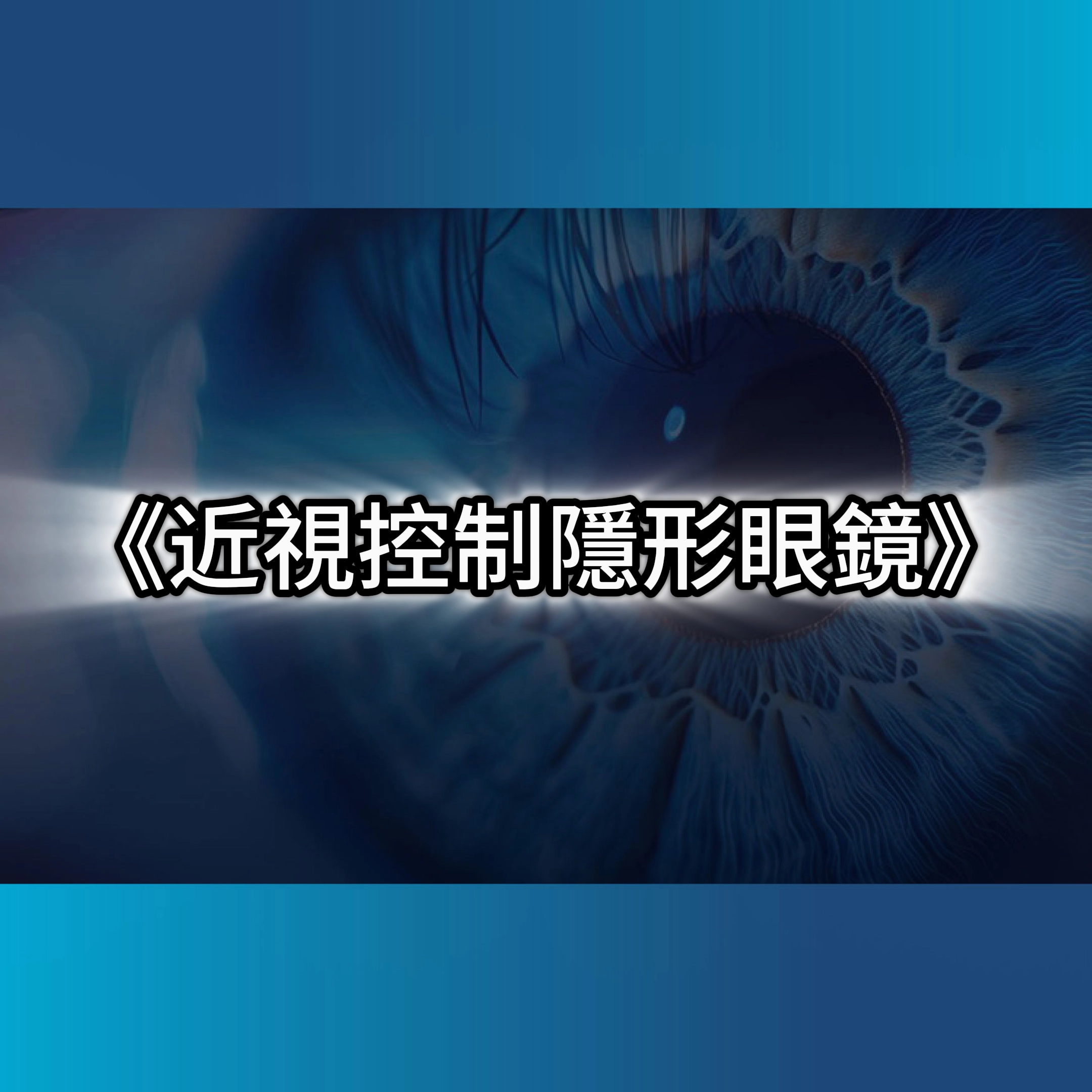 隱形眼鏡,庫柏隱眼,近視控制,兒童近視控制