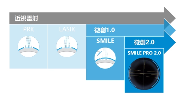 smilepro全飛秒近視雷射smile pro 2.0