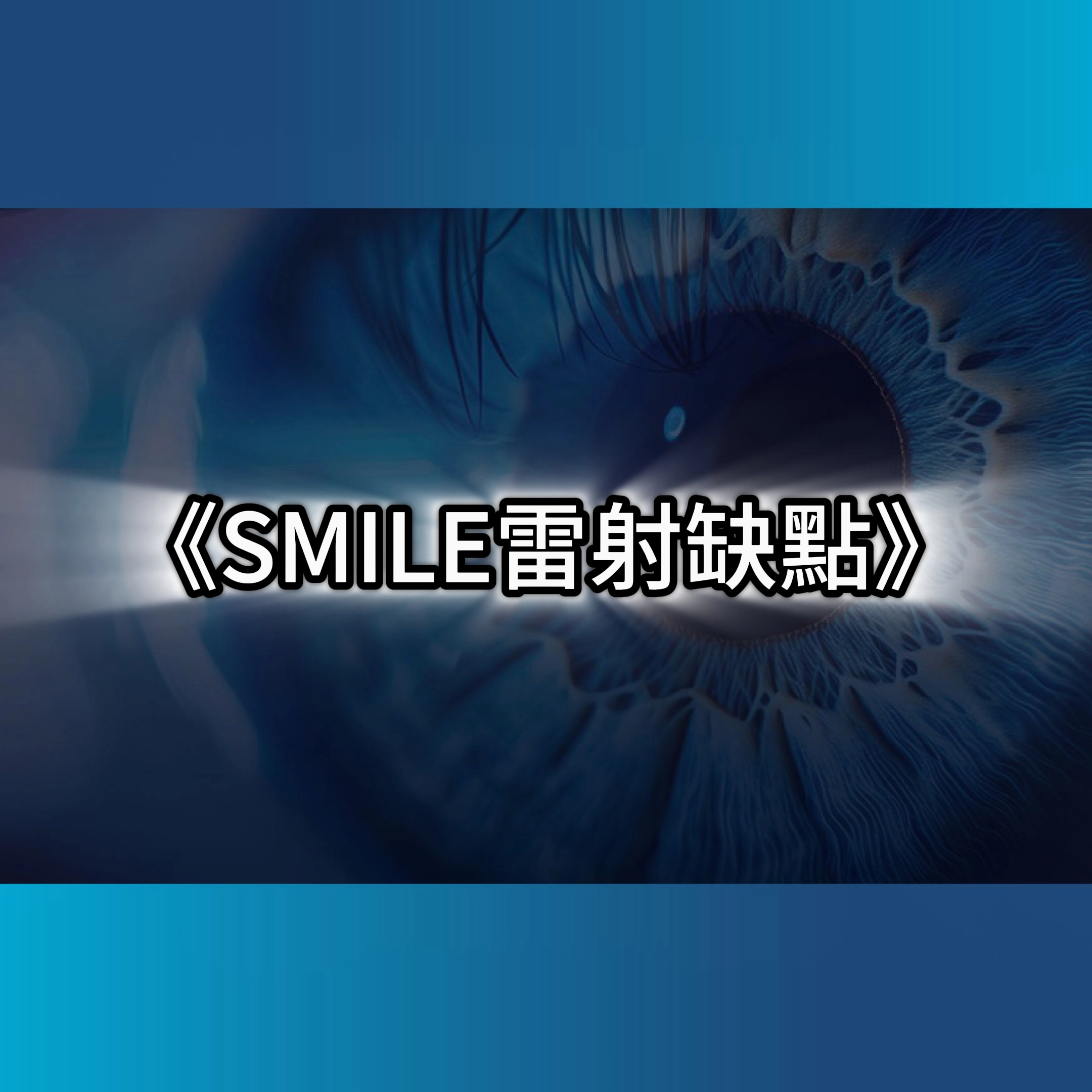 smile雷射缺點,Smile雷射失敗,近視雷射費用