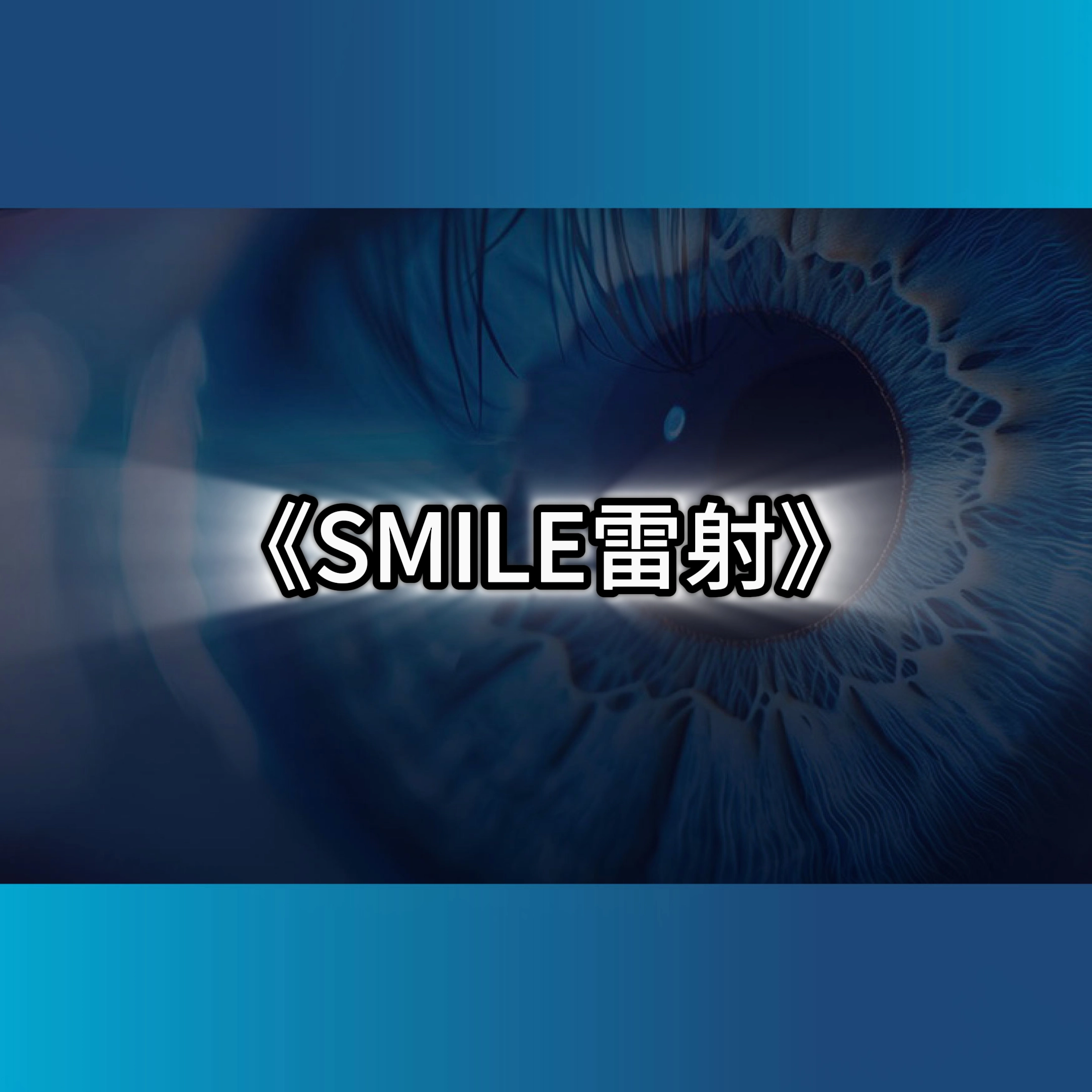 smile雷射,smile雷射價格,smile雷射術後