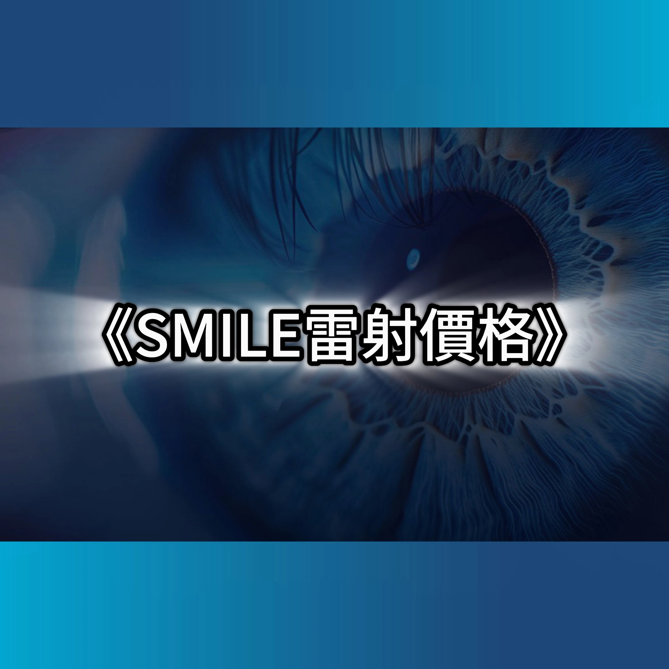 smile雷射價格,smile雷射,近視雷射手術