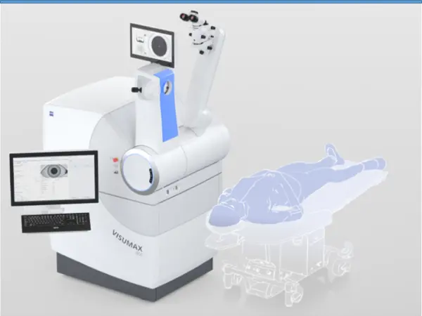 Smile Pro缺點smile pro全飛秒smile pro雷射